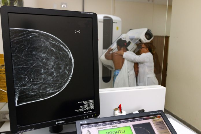 Governo do Estado oferta mais de 69% das mamografias em Salvador; dado ainda não contabiliza Feiras de Saúde e ações do Outubro Rosa